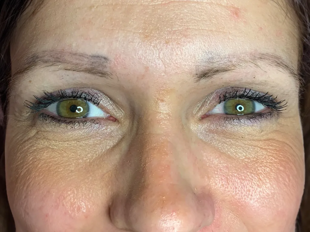 Microblading-Alternative Augenbrauentransplantation - Dion Hair Clinic